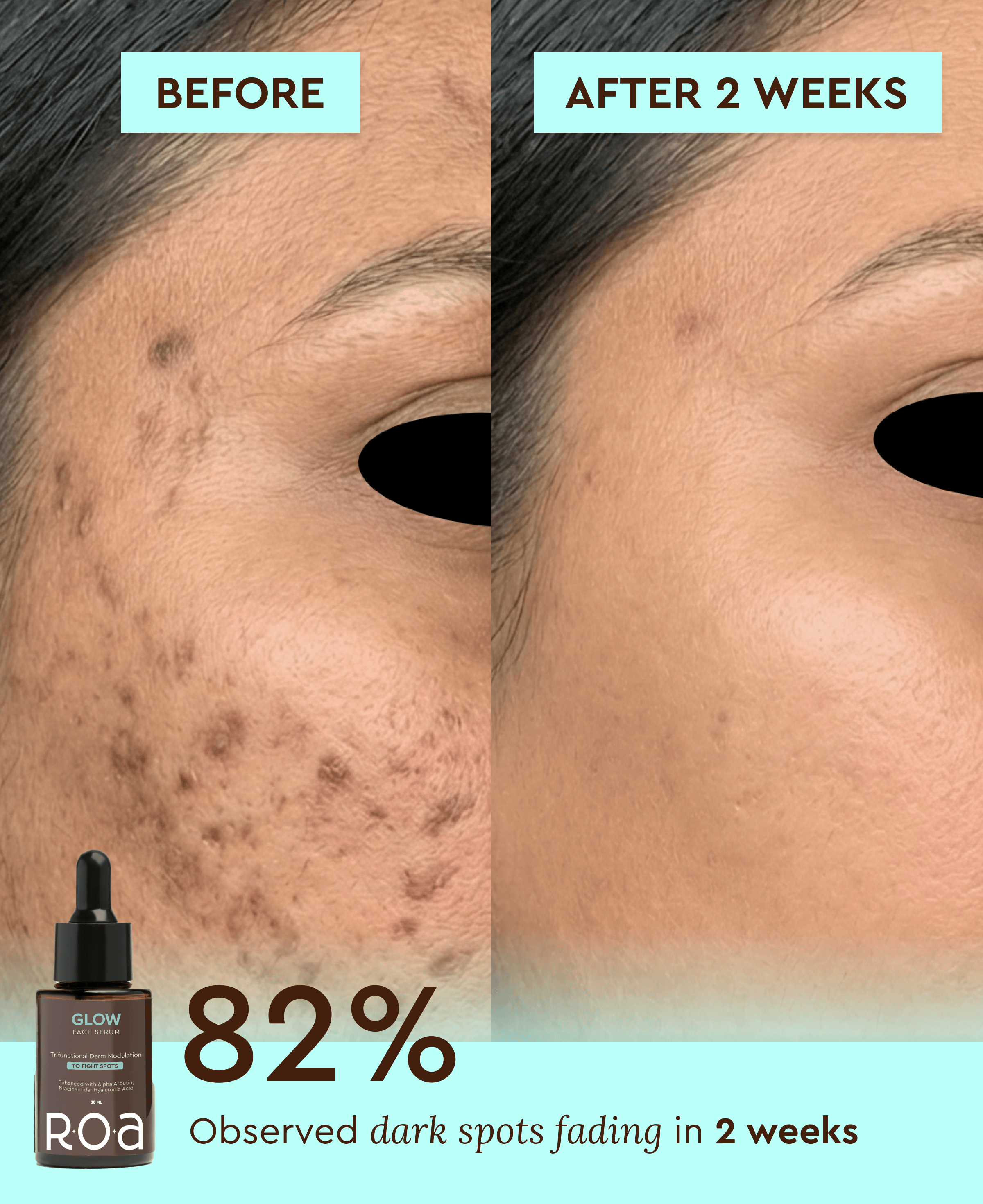 GLOW - DAILY BRIGHTENING & PORE REFINING SERUM
