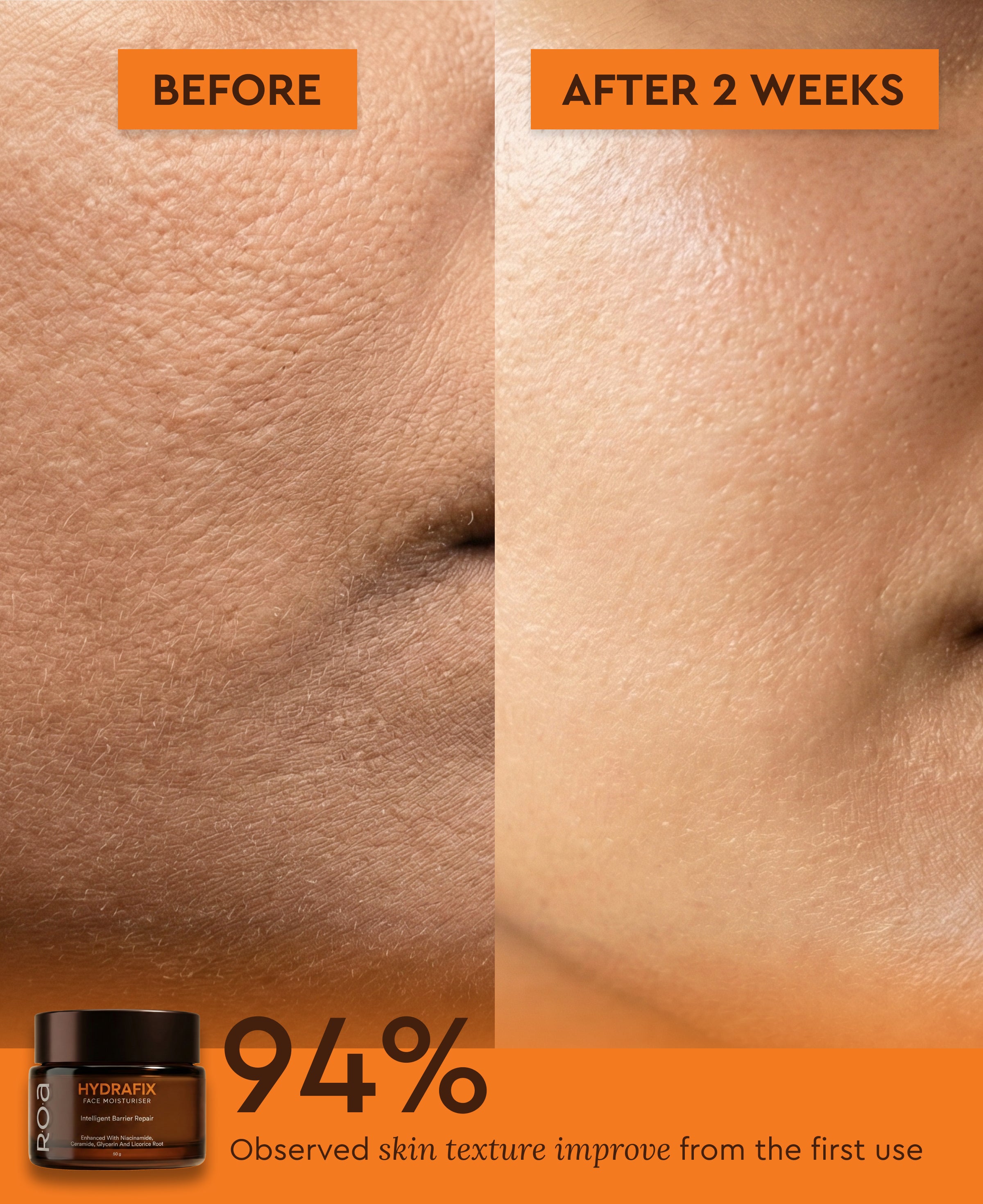 HYDRAFIX MOISTURISER FOR DRY SKIN