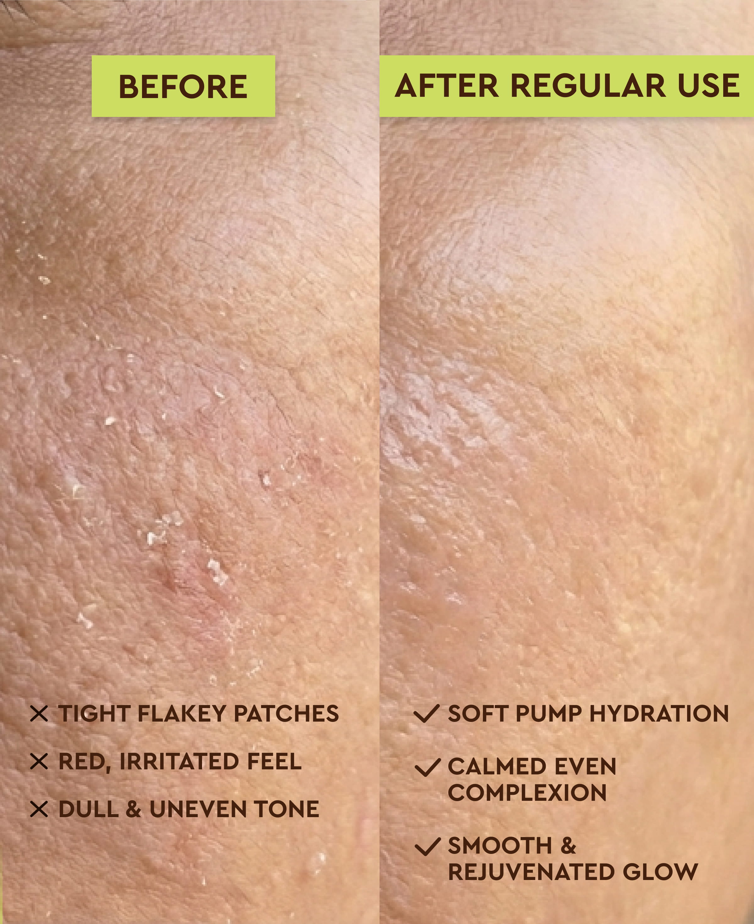ROA SKINCARE AQUA CENTELLA CLEANSER FOR DRY OR SENSITIVE SKIN