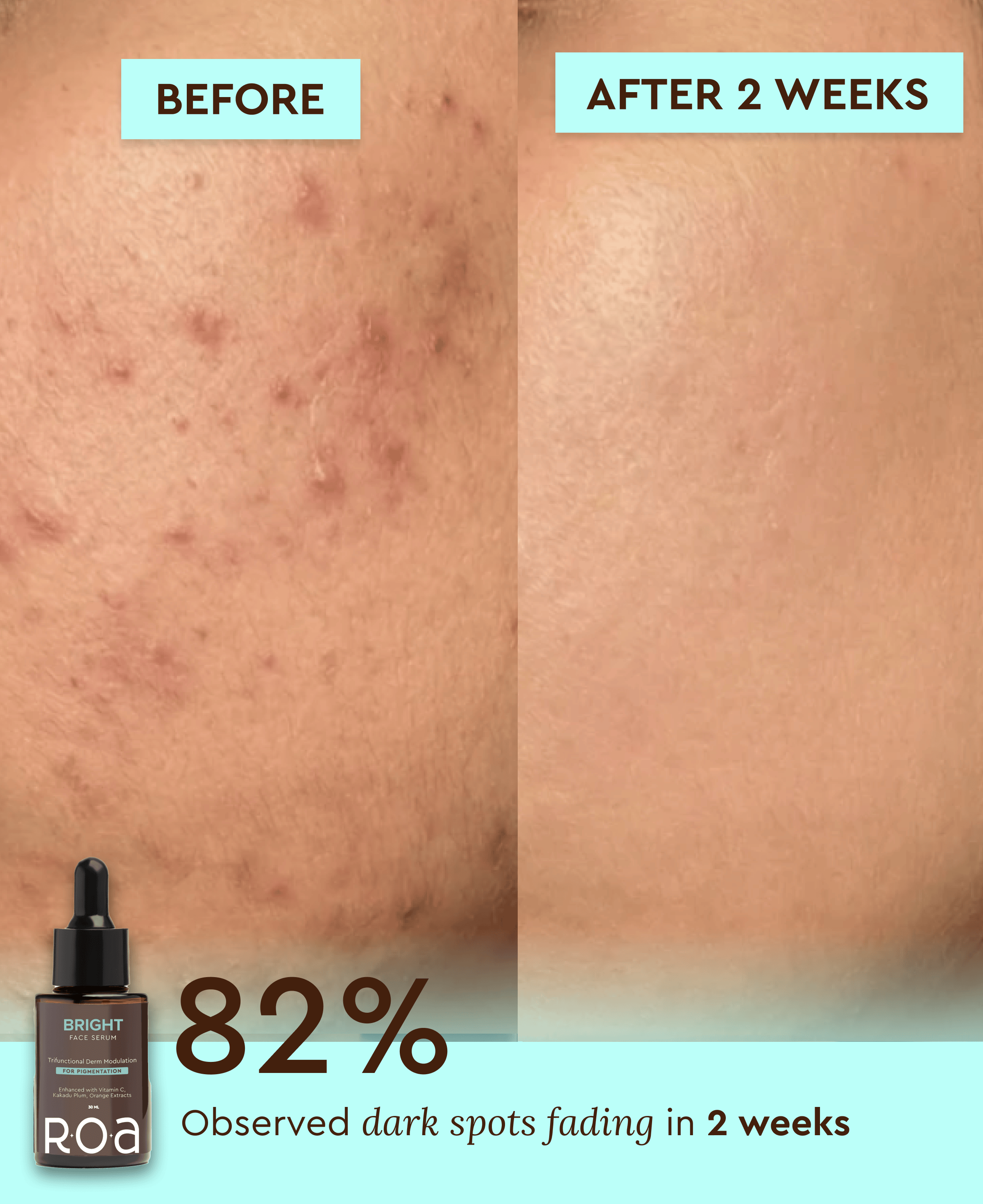 BRIGHT – 10% VITAMIN C FACE SERUM