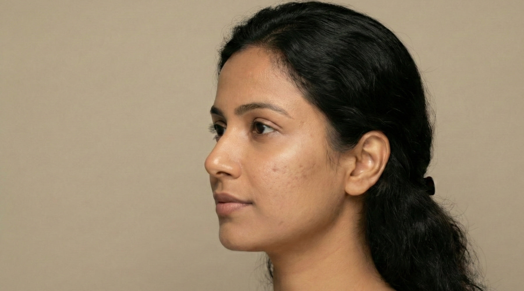 face wash for pimples and acne