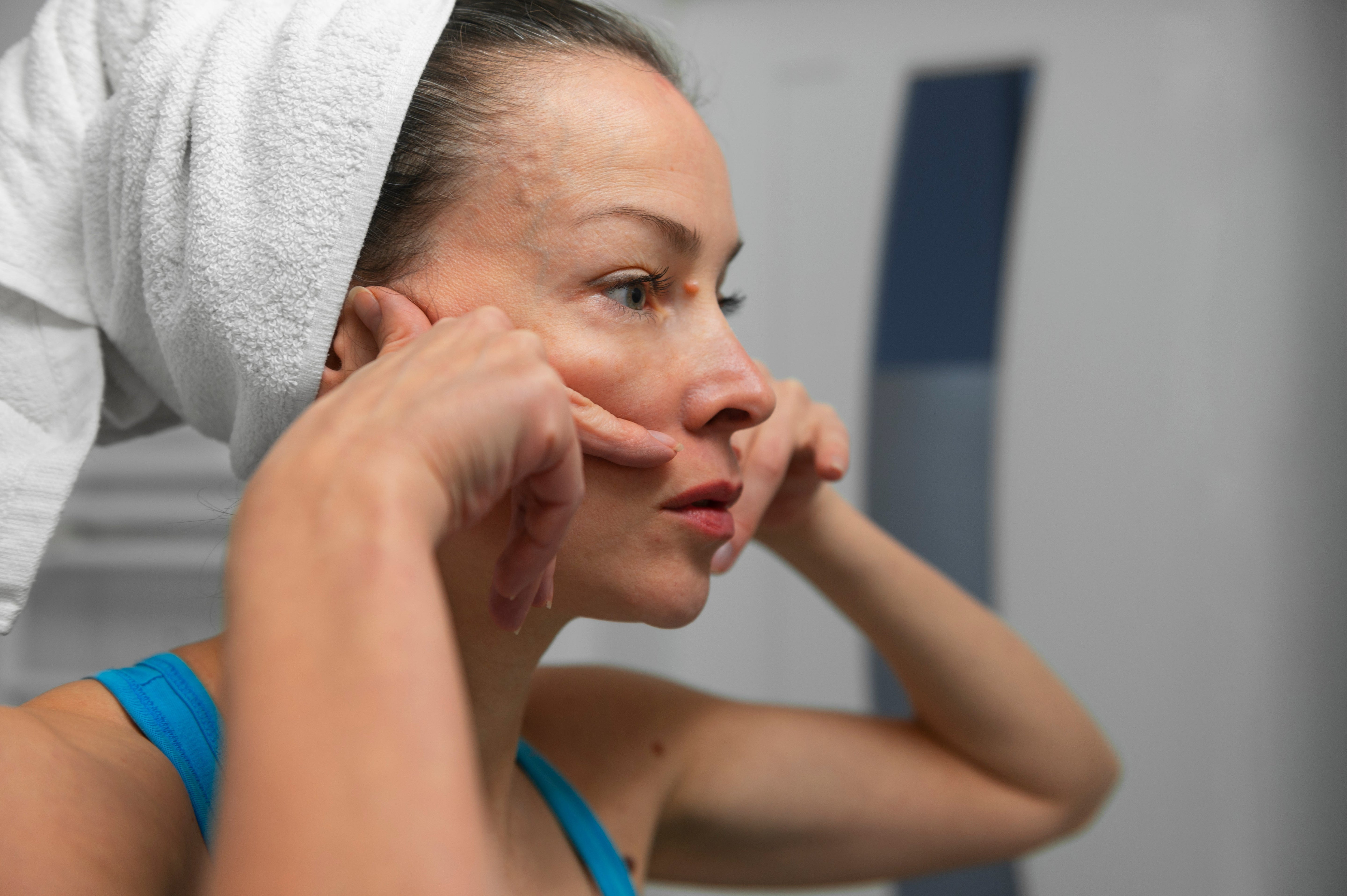 What Is Skin Pigmentation?
