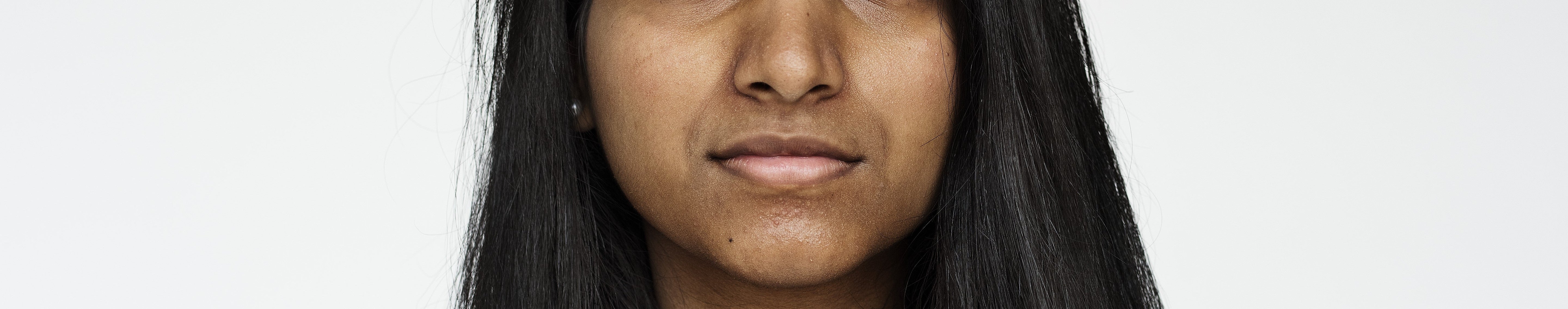 How to Remove Pigmentation Around Mouth  