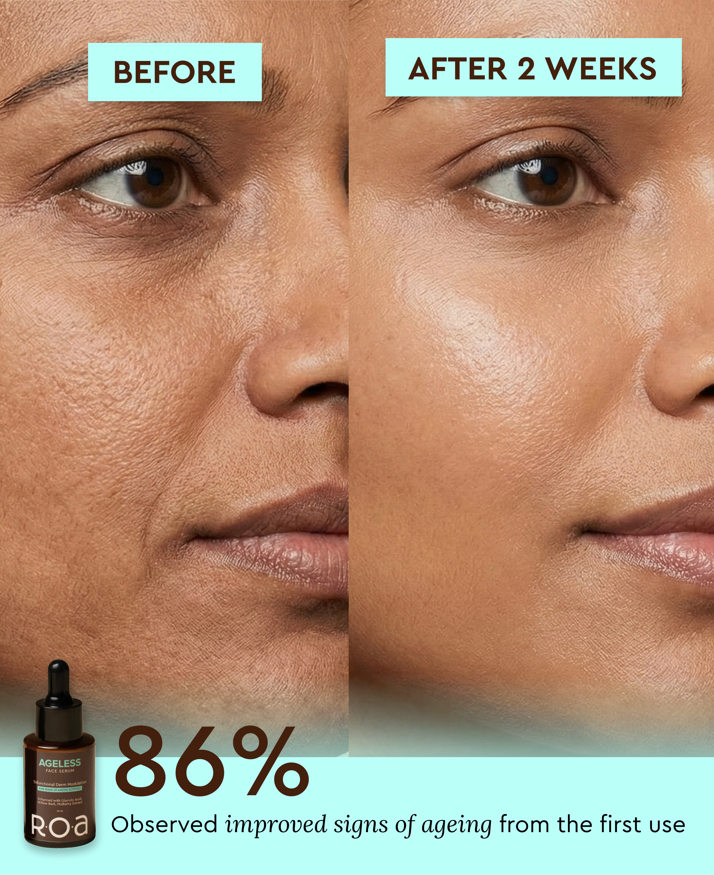 AGELESS - AHA BHA DUAL ACTION FACE SERUM