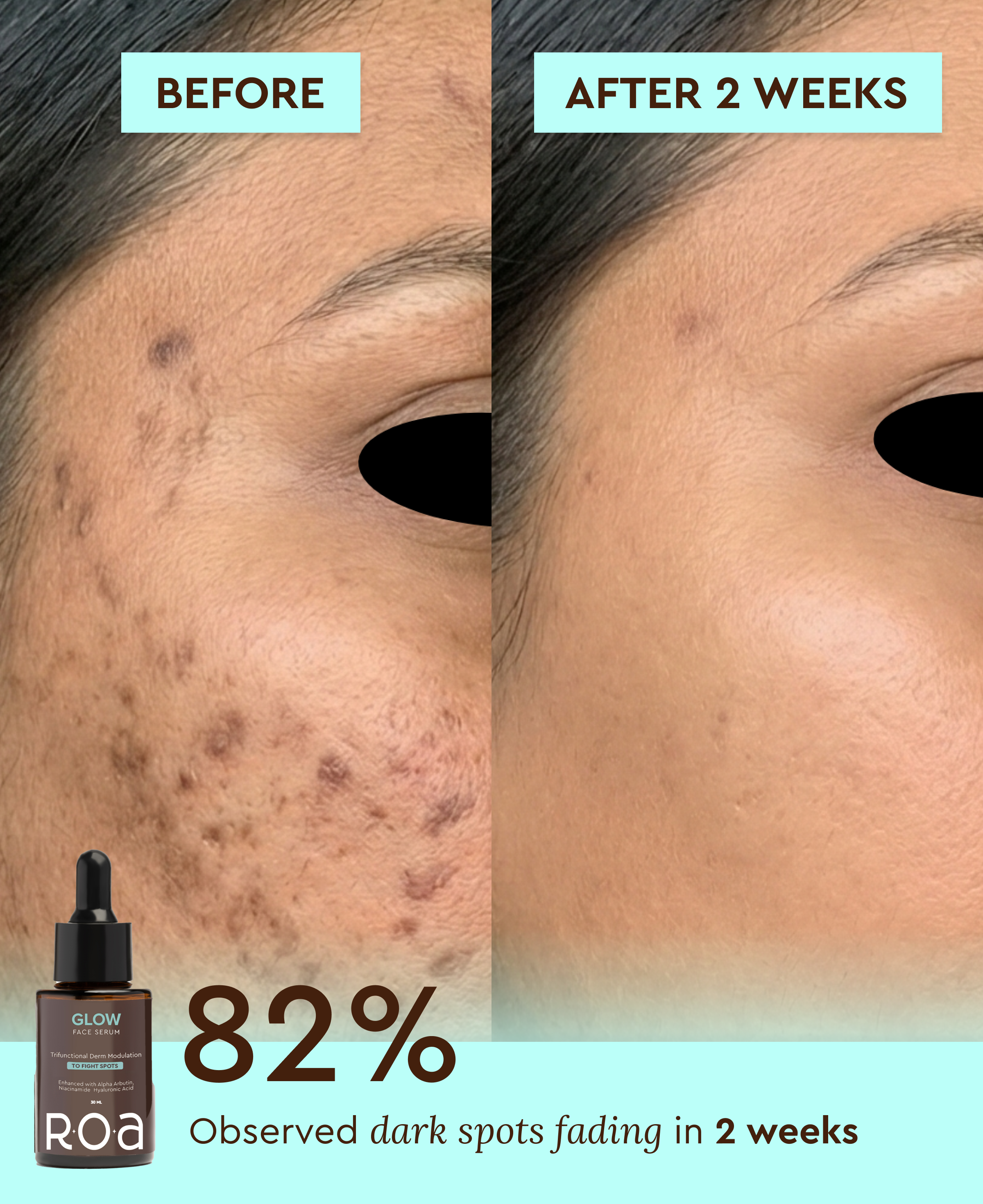 GLOW - DAILY BRIGHTENING & PORE REFINING SERUM