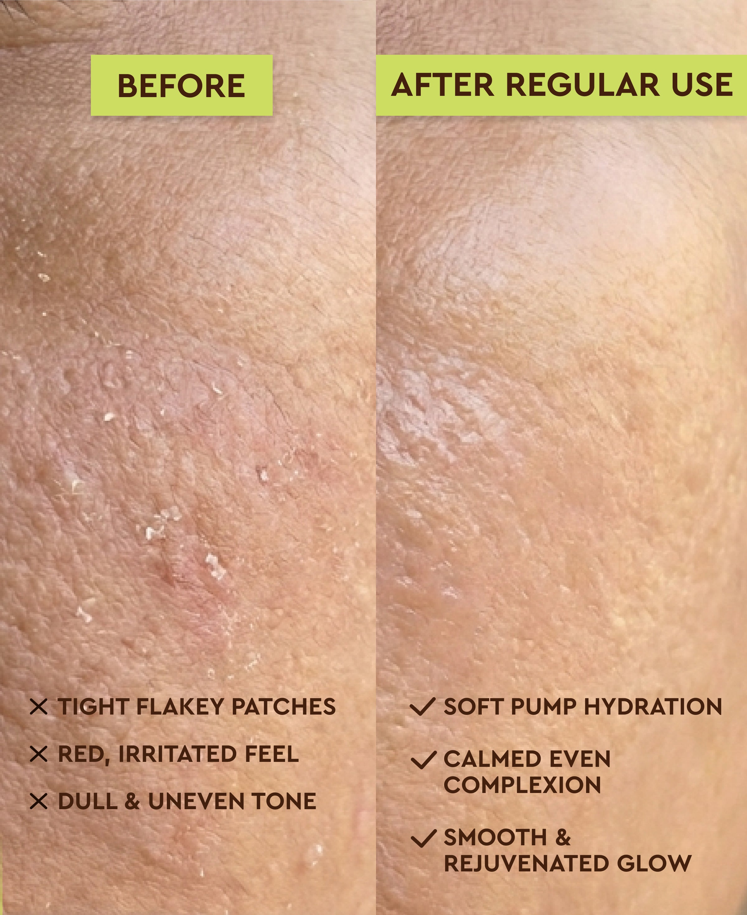 ROA SKINCARE AQUA CENTELLA CLEANSER FOR DRY OR SENSITIVE SKIN