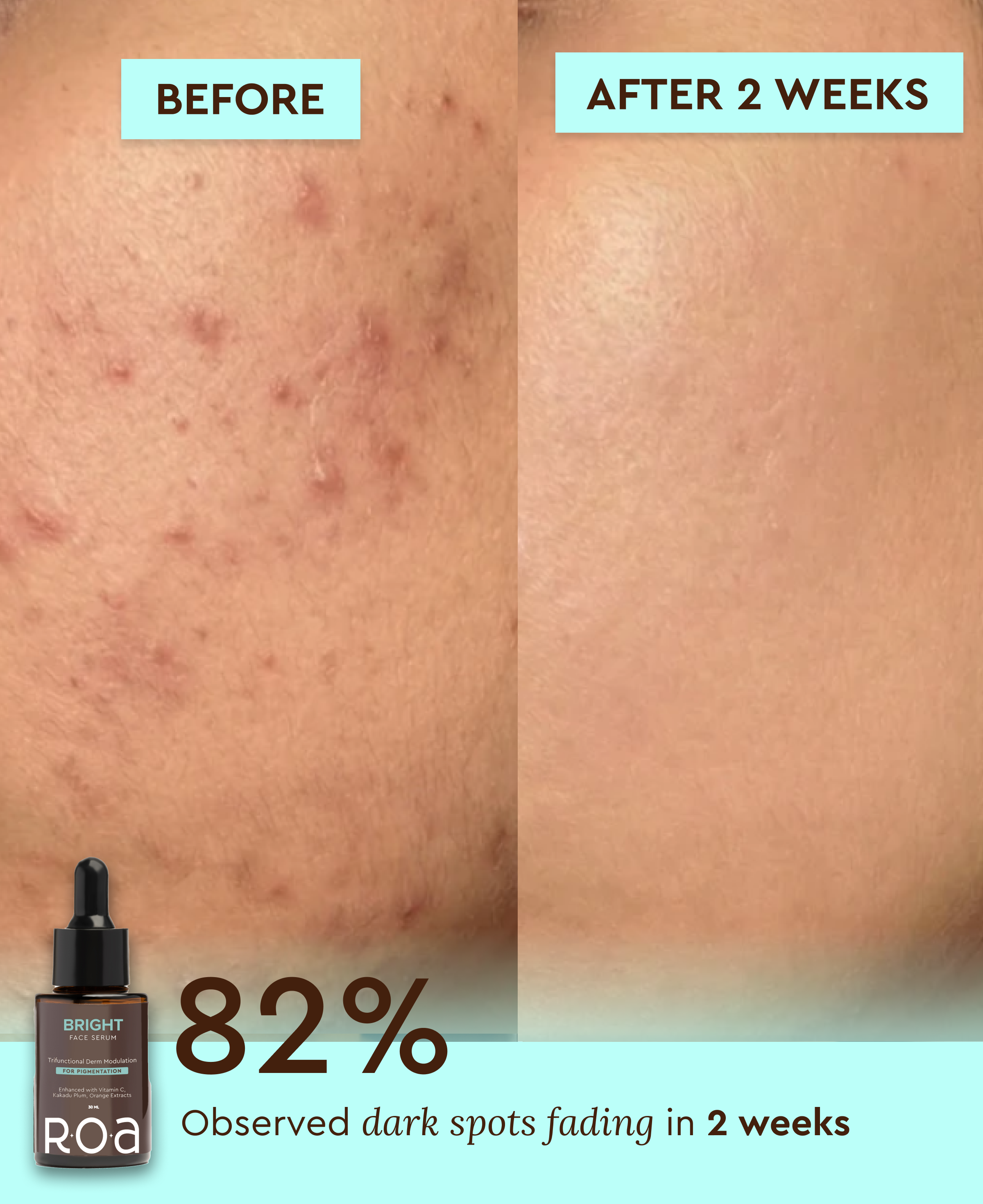 BRIGHT – 10% VITAMIN C FACE SERUM