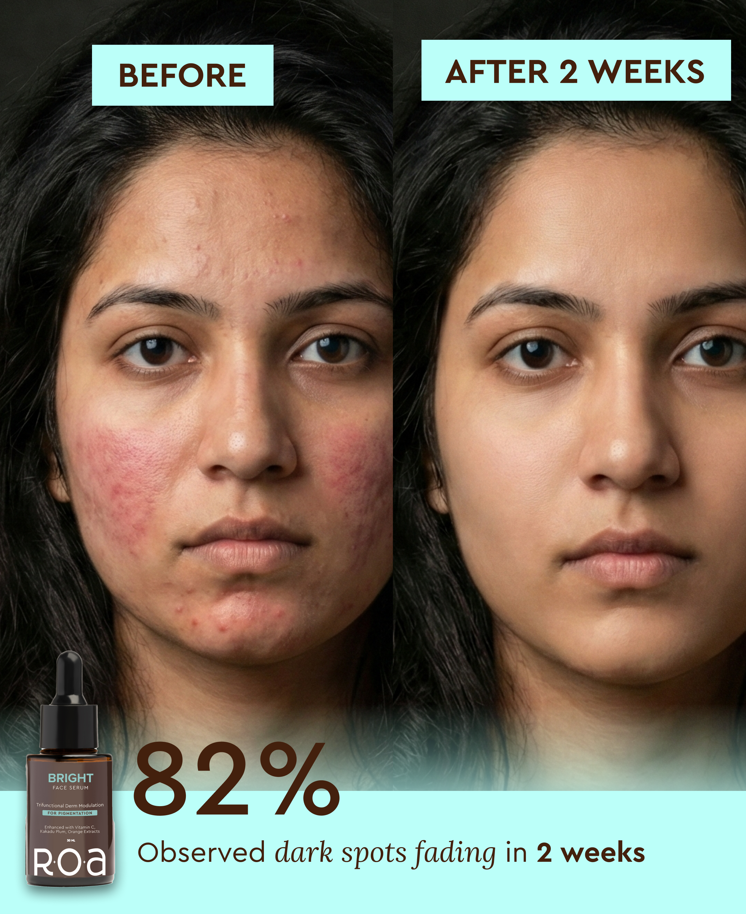 BRIGHT – 10% VITAMIN C FACE SERUM